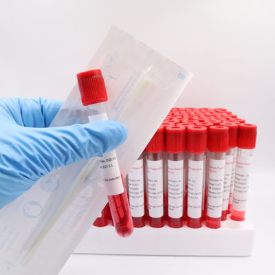 Трубки 4ml образца крови ЛЮБИМЦА образцов Coronavirus